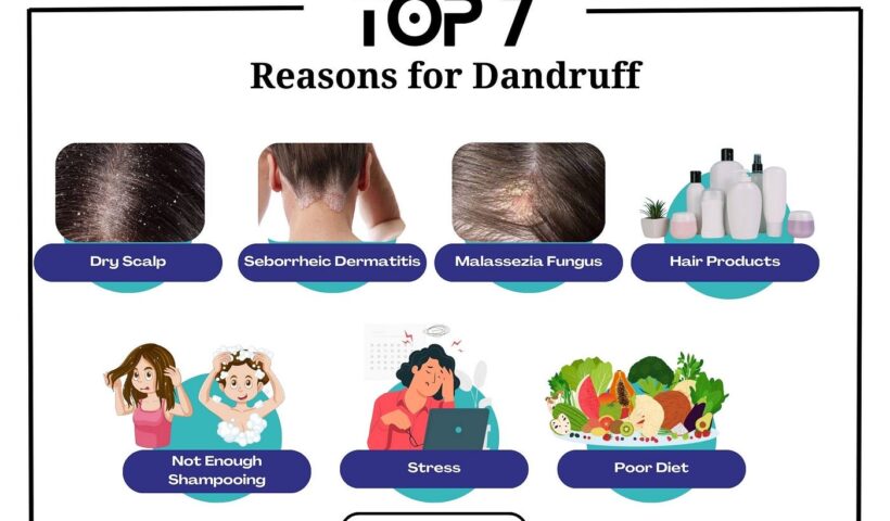 The importance of properly addressing dandruff