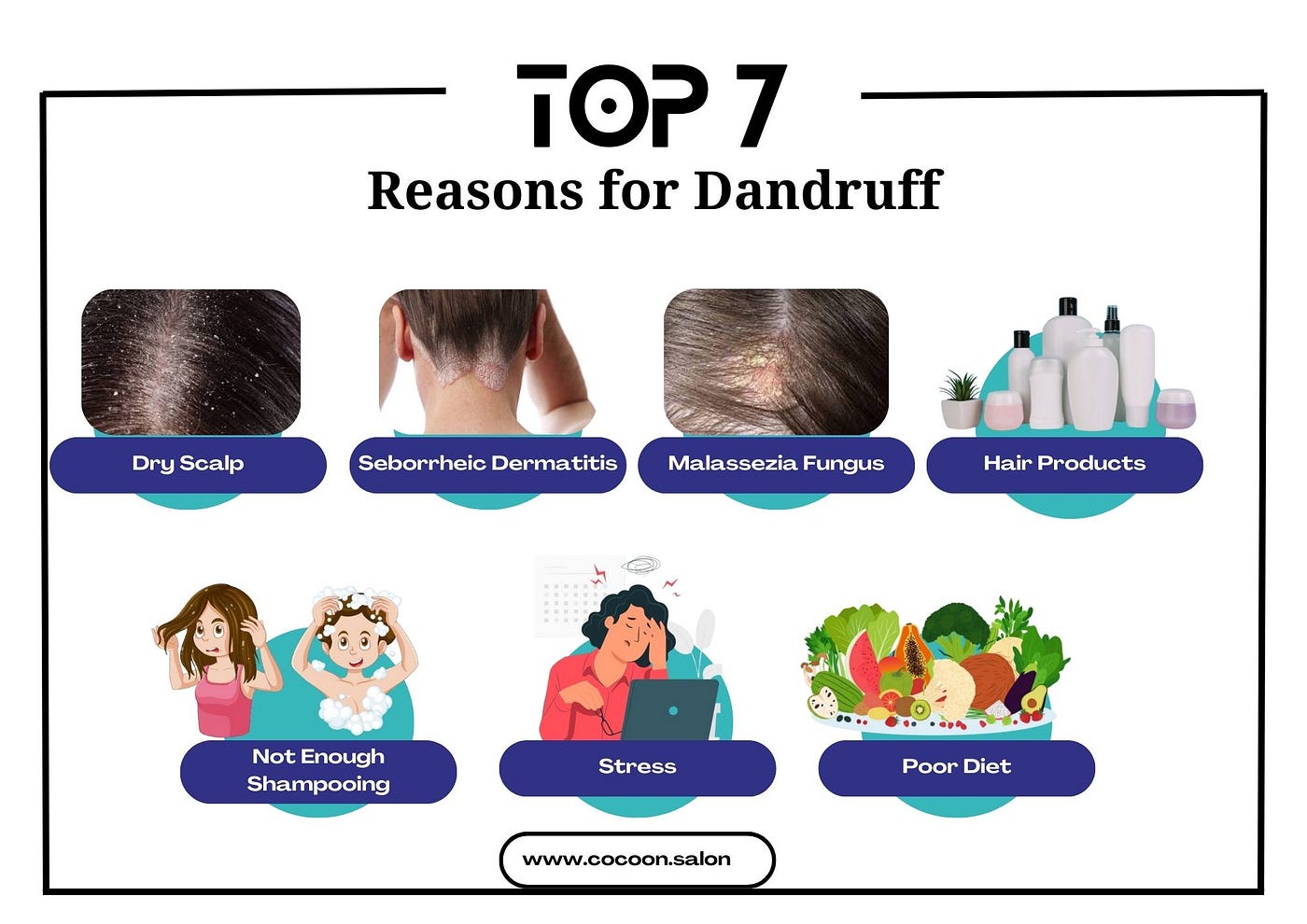 The importance of properly addressing dandruff